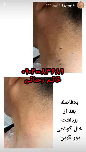da5G1mTHvo