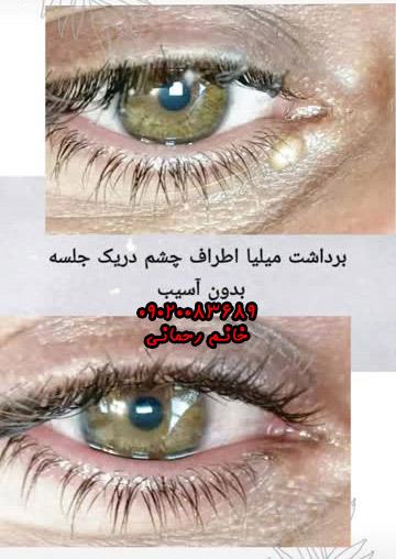 nSeyHNbVap