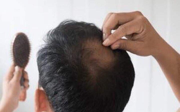 مراقب ریزش مو در سفر باشید-uvhqKnz6E2